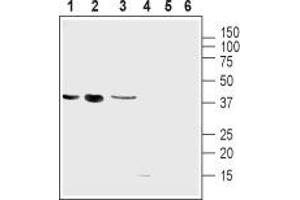 Uncoupling Protein 2 (Mitochondrial, Proton Carrier) (UCP2) peptide