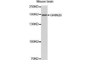 Western Blotting (WB) image for anti-Glutamate Receptor, Ionotropic, N-Methyl D-Aspartate 2B (GRIN2B) (C-Term) antibody (ABIN1680110) (GRIN2B 抗体  (C-Term))