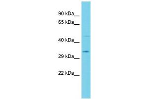 Host: Rabbit  Target Name: Acbd6  Sample Tissue: Rat Stomach lysates  Antibody Dilution: 1. (ACBD6 抗体  (Middle Region))