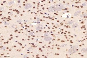 Immunohistochemistry analysis of paraffin-embedded mouse striatum using,PARC (ABIN7073606) at dilution of 1: 1200 (CUL9 抗体)