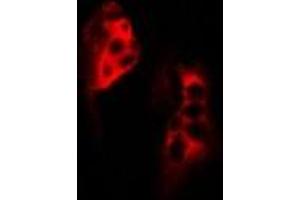 Immunofluorescent analysis of SCYL1 staining in MCF7 cells. (SCYL1 抗体)