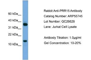 WB Suggested Anti-PRR15  Antibody Titration: 0. (Proline Rich 15 抗体  (Middle Region))