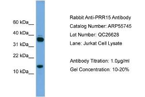 WB Suggested Anti-PRR15  Antibody Titration: 0.