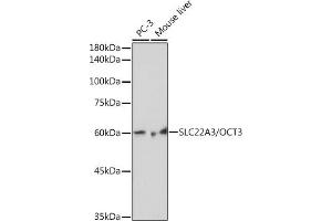 Western blot analysis of extracts of various cell lines, using SLC22/OCT3 Rabbit mAb (ABIN7269107) at 1:1000 dilution. (SLC22A3 抗体)