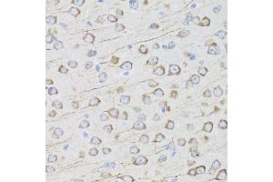 Immunohistochemistry of paraffin-embedded mouse brain using MIP antibody (ABIN3016917, ABIN3016918, ABIN3016919 and ABIN6219879) at dilution of 1:100 (40x lens). (Mip (AA 50-150) 抗体)