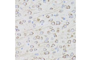 Immunohistochemistry of paraffin-embedded mouse brain using MIP antibody (ABIN3016917, ABIN3016918, ABIN3016919 and ABIN6219879) at dilution of 1:100 (40x lens). (Mip (AA 50-150) 抗体)