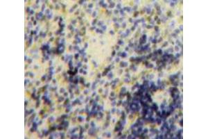 Used in DAB staining on fromalin fixed paraffin-embedded Spleen tissue (B-Cell Linker 抗体  (AA 65-314))