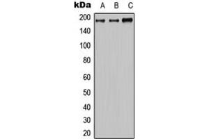 Western blot analysis of MRP2 expression in HeLa (A), mouse brain (B), H9C2 (C) whole cell lysates. (ABCC2 抗体  (Center))
