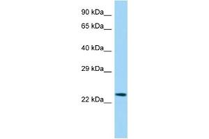 Host:  Rabbit  Target Name:  Etv3l  Sample Type:  Rat Spleen lysates  Antibody Dilution:  1. (ETV3L 抗体  (Middle Region))