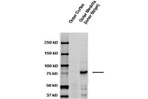 Western blot analysis of Rat kidney tissue lysates showing detection of ENaC protein using Rabbit Anti-ENaC Polyclonal Antibody . (SCNN1A 抗体  (AA 629-650) (Atto 488))