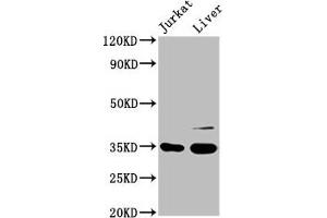 Western Blot Positive WB detected in: Jurkat whole cell lysate, Rat liver tissue All lanes: GAS2 antibody at 3. (GAS2 抗体  (AA 1-141))
