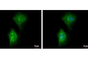 ICC/IF Image PDE4B antibody detects PDE4B protein at cytoplasm by immunofluorescent analysis. (PDE4B 抗体)
