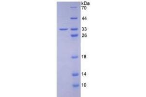 SDS-PAGE of Protein Standard from the Kit (Highly purified E. (C1QBP ELISA 试剂盒)