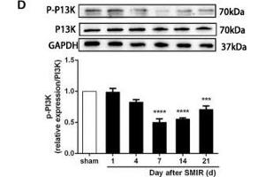 The CXCR7 and PI3K/Akt signaling pathways are involved in CPSP in the dorsal horn of the spinal cord. (GAPDH 抗体)
