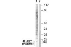 Western Blotting (WB) image for anti-Eukaryotic Translation Initiation Factor 4E Binding Protein 1 (EIF4EBP1) (AA 30-79), (pSer64) antibody (ABIN1531250)