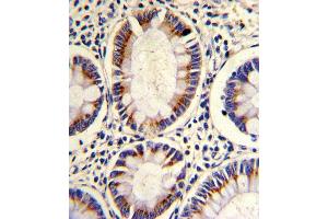 Immunohistochemistry (Paraffin-embedded Sections) (IHC (p)) image for anti-Sorbin and SH3 Domain Containing 2 (Sorbs2) (AA 175-204), (N-Term) antibody (ABIN652279)