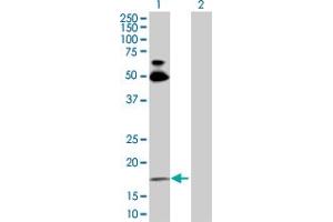 Western Blot analysis of RHOB expression in transfected 293T cell line by RHOB MaxPab polyclonal antibody.