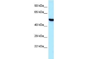Western Blotting (WB) image for anti-threonyl-tRNA Synthetase 2, Mitochondrial (TARS2) (C-Term) antibody (ABIN2789298) (TARS2 抗体  (C-Term))
