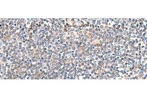 Immunohistochemistry of paraffin-embedded Human tonsil tissue using ITGA3 Polyclonal Antibody at dilution of 1:45(x200) (ITGA3 抗体)