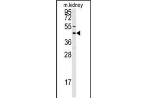 Western blot analysis of anti-GJA8 Antibody in mouse kidney tissue lysates (35ug/lane) (GJA8 抗体  (C-Term))