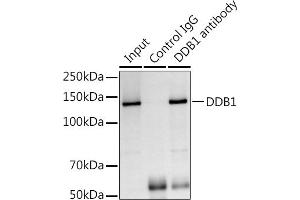 Immunoprecipitation analysis of 300 μg extracts of Jurkat cells using 3 μg DDB1 antibody (ABIN1679509, ABIN5664466, ABIN5664468 and ABIN6220382). (DDB1 抗体  (C-Term))
