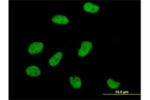 Immunofluorescence of purified MaxPab antibody to AOF2 on HeLa cell. (LSD1 抗体  (AA 1-876))