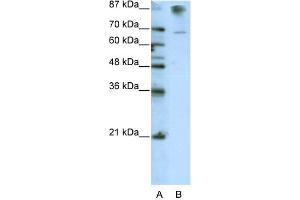 WB Suggested Anti-HKR1 Antibody Titration:  0. (HKR1 抗体  (C-Term))
