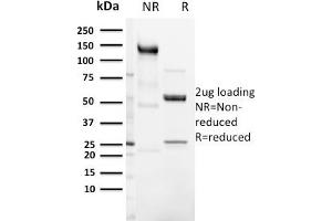 SDS-PAGE Analysis Purified CD3e Rabbit Recombinant Monoclonal Antibody (C3e/3125R). (Recombinant CD3 epsilon 抗体  (AA 23-119))