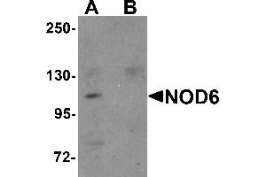 Western Blotting (WB) image for anti-NLR Family, Pyrin Domain Containing 9 (NLRP9) (N-Term) antibody (ABIN1031485) (NLRP9 抗体  (N-Term))