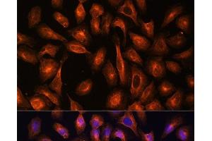 Immunofluorescence (IF) image for anti-Spectrin alpha Chain, Brain (SPTAN1) antibody (ABIN7254764)