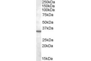 Image no. 1 for anti-Bradykinin Receptor B1 (BDKRB1) (Internal Region) antibody (ABIN375179) (BDKRB1 抗体  (Internal Region))