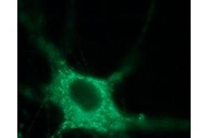Immunocytochemistry (ICC) image for anti-Sodium Channel, Voltage-Gated, Type IX, alpha Subunit (SCN9A) (AA 446-460), (Intracellular) antibody (ABIN7043647)