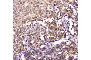 IHC analysis of 14-3-3 zeta/delta using anti-14-3-3 zeta/delta antibody . (14-3-3 zeta 抗体)