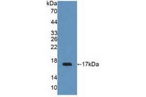 Detection of Recombinant UPK2, Human using Polyclonal Antibody to Uroplakin 2 (UPK2) (Uroplakin 2 抗体  (AA 26-153))