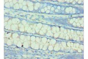 Immunohistochemistry of paraffin-embedded human colon tissue using ABIN7154026 at dilution of 1:100 (QARS 抗体  (AA 1-250))