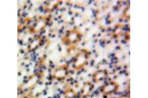 IHC-P analysis of Kidney tissue, with DAB staining. (Granulin 抗体  (AA 361-585))