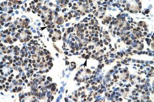 Image no. 1 for anti-Homeobox B5 (HOXB5) (N-Term) antibody (ABIN6735845) (HOXB5 抗体  (N-Term))