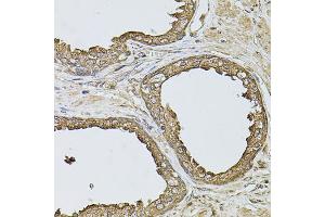 Immunohistochemistry of paraffin-embedded human prostate using ANXA8L2 antibody (ABIN5975720) at dilution of 1/100 (40x lens).