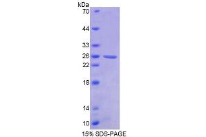 SDS-PAGE analysis of Human BCR Protein. (BCR 蛋白)