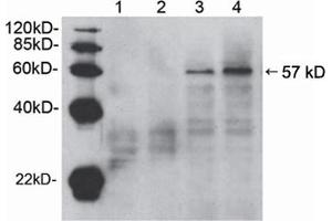 Western blot analysis of cell lysates from HEK-293 (lane 1 and 3) and NIH/3T3 (lane 2 and 4) cells,using Rabbit Anti-Akt (Ser473) Polyclonal Antibody (ABIN398622) . (AKT1 抗体  (pSer473))