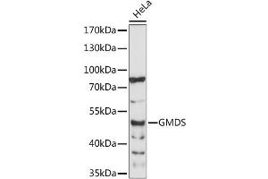 Western blot analysis of extracts of HeLa cells, using GMDS antibody (ABIN6294083) at 1:1000 dilution. (GMDS 抗体)