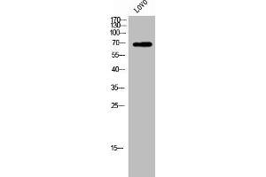 Western Blot analysis of LOVO cells using ZP1 Polyclonal Antibody (ZP1 抗体  (Internal Region))