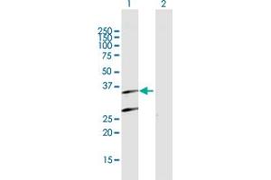 Western Blot analysis of PSMB7 expression in transfected 293T cell line by PSMB7 MaxPab polyclonal antibody. (PSMB7 抗体  (AA 1-277))