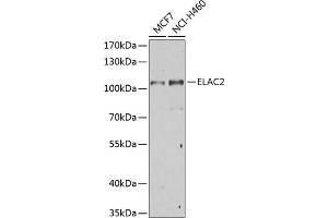 Western blot analysis of extracts of various cell lines, using EL Antibody (ABIN6132052, ABIN6140108, ABIN6140109 and ABIN6222942) at 1:1000 dilution. (ELAC2 抗体  (AA 1-270))