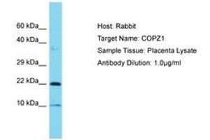 Image no. 1 for anti-Coatomer Protein Complex, Subunit zeta 1 (COPZ1) (C-Term) antibody (ABIN6750829) (COPZ1 抗体  (C-Term))