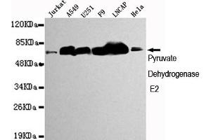 Western blot detection of Pyruvate Dehydrogenase E2 in Jurkat,A549,,F9,Lncap and Hela cell lysates using Pyruvate Dehydrogenase E2 mouse mAb (1:1000 diluted). (CYB561 抗体)