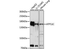 ATP11C 抗体  (AA 430-650)