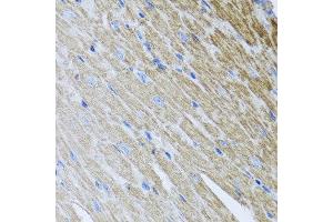 Immunohistochemistry of paraffin-embedded mouse heart using MTX2 antibody at dilution of 1:100 (x40 lens). (MTX2 抗体)