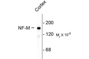 Image no. 1 for anti-Neurofilament Triplet M Protein (NEFM) (C-Term) antibody (ABIN372674) (NEFM 抗体  (C-Term))