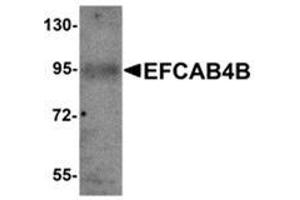 Western blot analysis of EFCAB4B in mouse kidney tissue lysate with EFCAB4B antibody at 1 μg/ml.